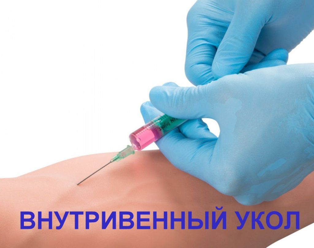 Освещение под навесом частного дома своими руками 223 Освещение под навесом частного дома своими руками 585