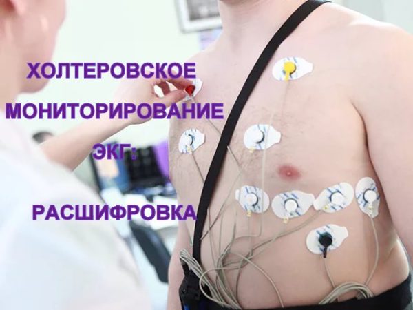 Холтеровское мониторирование ЭКГ: расшифровка - Дао для женщин