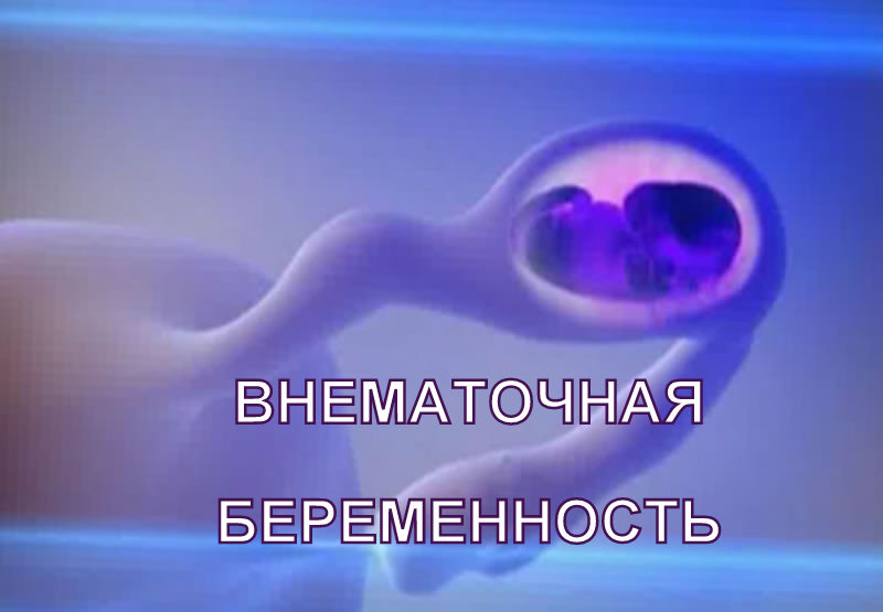 Смотреть фильм онлайн судьба турецкий сериал на русском языке