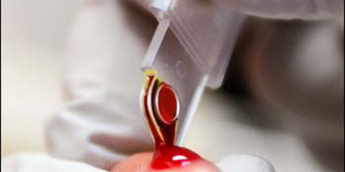 общий-анализ