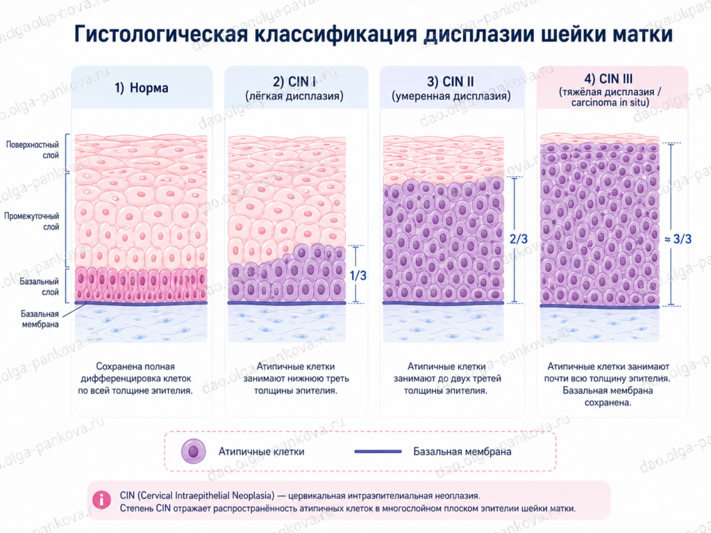 классификация дисплазии