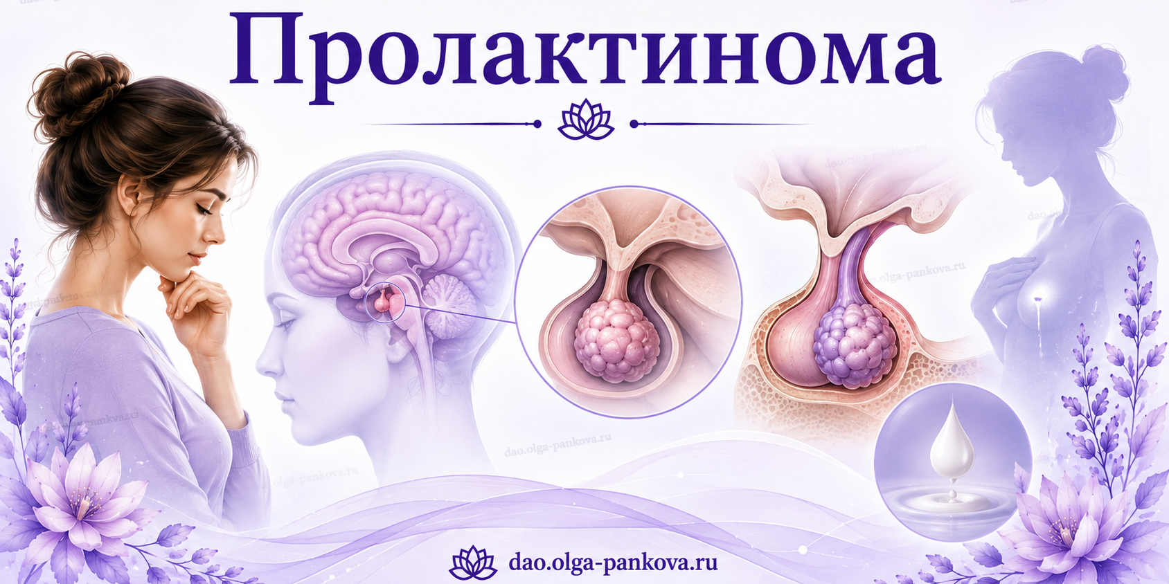 пролактинома