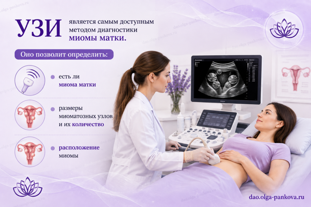 миома узи