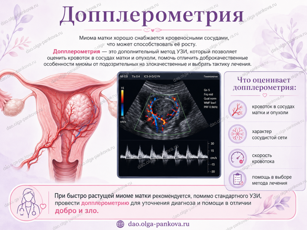 допплер миома