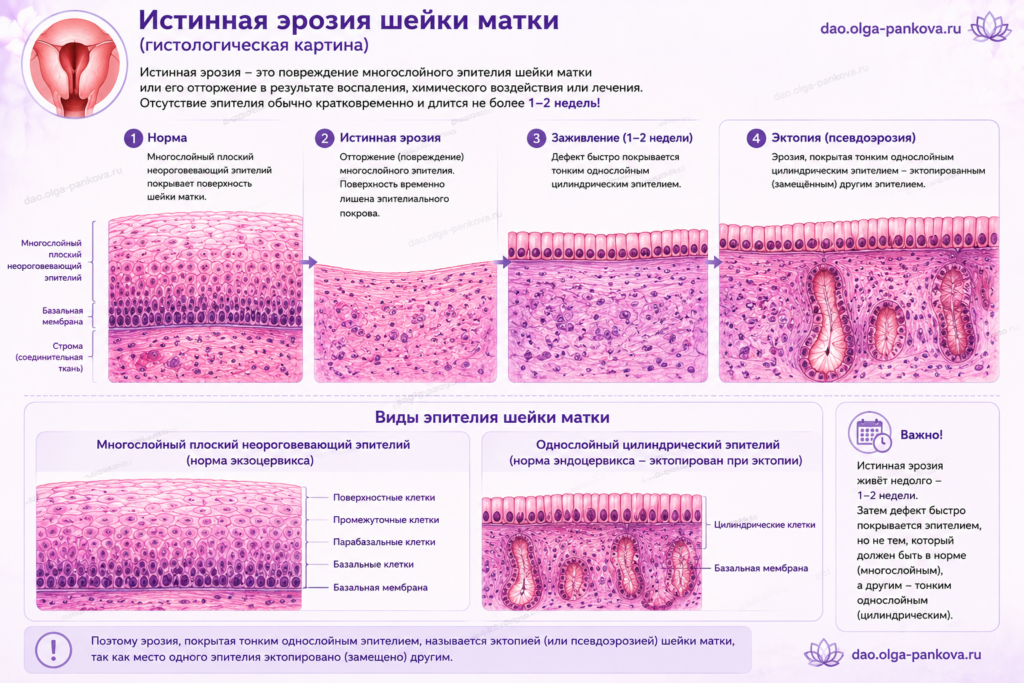 эрозия и эктопия