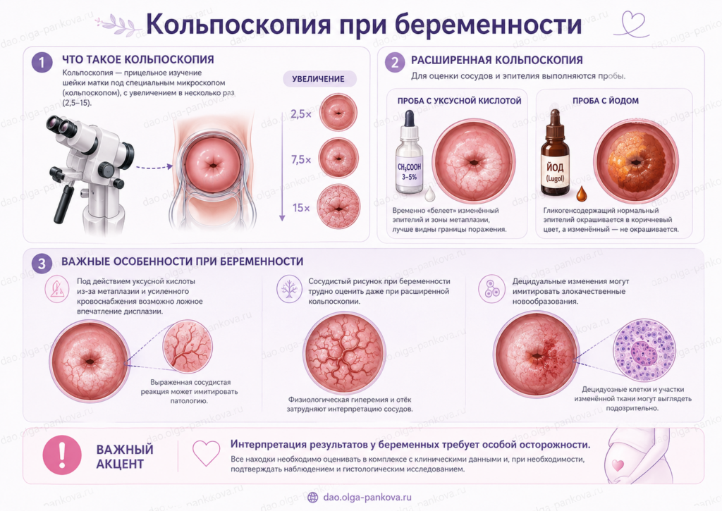 кольпоскопия беременность