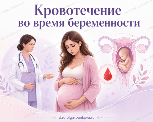 кровотечение и беременность
