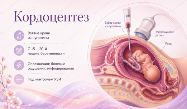 кордоцентез