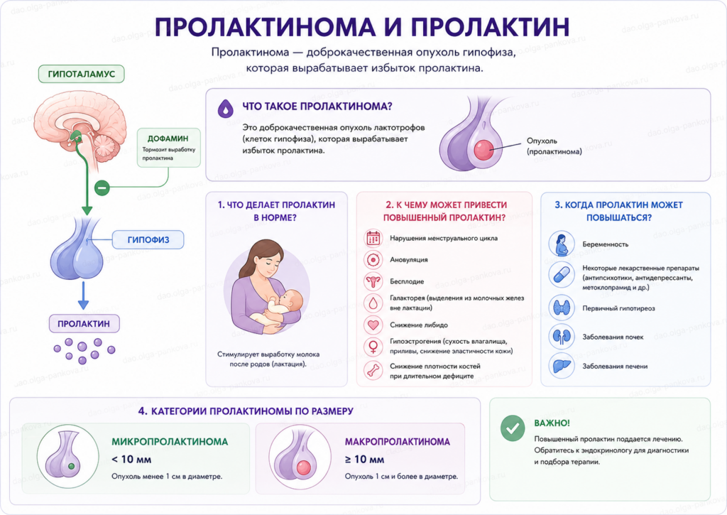 пролактинома