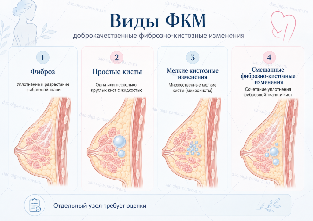 мастопатия