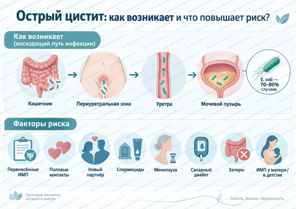 цистит