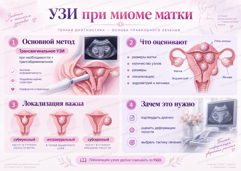 миома