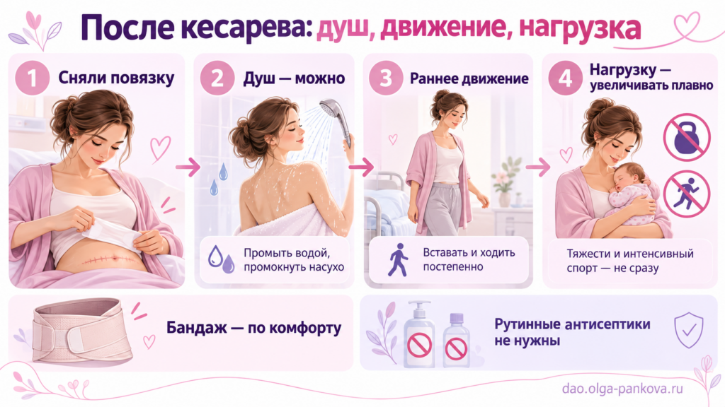 швы