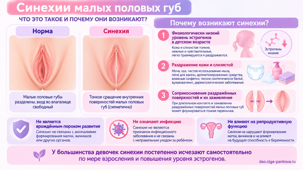 Синехии малых половых губ_ причины и факты